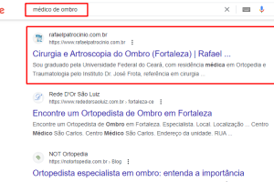 serp-ombro-fortaleza.png